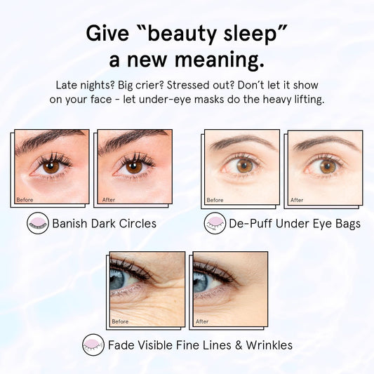 grace & stella Retinol Under Eye Patches for Puffy Eyes and Dark Circles - Restoring Gel Under Eye Masks with Hyaluronic Acid - Vegan Cruelty-Free Skincare, Birthday Gifts for Women (Purple, 24 Pairs)